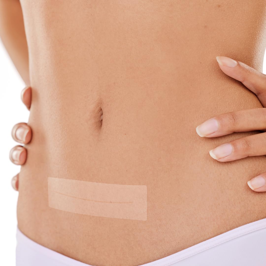 Marena Silicone Scar Strips, 1 Count – Washable & Reusable, Scar Tape for Surgical Scars, Silicone Scar Sheet - Image 3